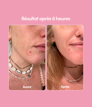 Blemish Patches pack