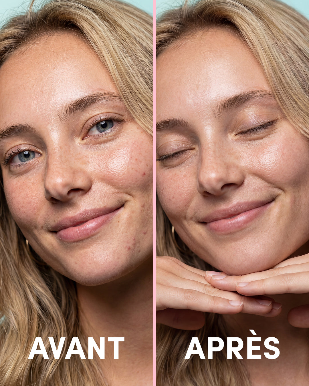 3 x 24 Patchs Boutons holo