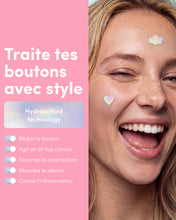 24 Patchs Boutons Unicorn Edition